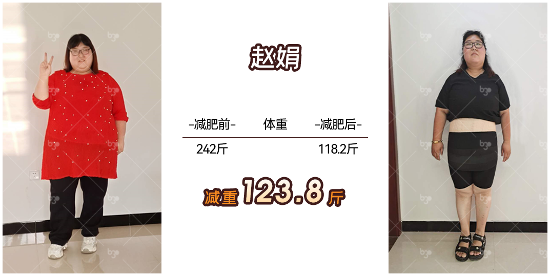 赵娟